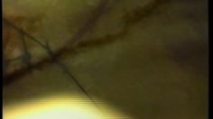 poster-11439-medecins-sans-frontieres-msf-couture-236x132