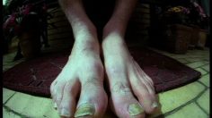 poster-11734-bianco-footwear-ugly-feet-236x132