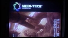 poster-12836-telia-operation-236x132