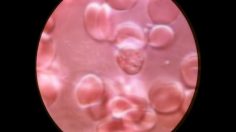 poster-16191-protection-sante-appel-aux-dons-microscope-236x132