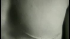 poster-1893-anti-cancer-cancer-du-sein-mammectomie-236x132