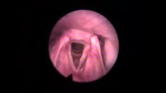 poster-22312-mtv-vocal-cords-236x132