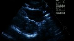 poster-2235-joy-lubricated-condom-echographie-236x132