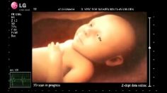 poster-23091-lg-smart-tv-the-smartest-baby-in-the-world-236x132