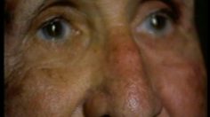 poster-2877-protection-sante-anti-alzheimer-souvenirs-236x132