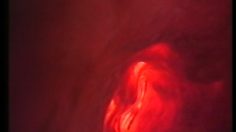 poster-4773-blvd-accouchement-236x132