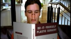 poster-635-optimix-funds-plastic-surgery-236x132