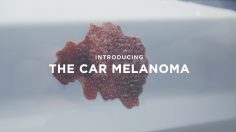 poster-28341-cancer-association-of-south-africa-cancer-de-la-peau-car-melanoma-236x132